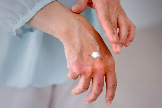 9 nguyên nhân chính gây ra đốm da