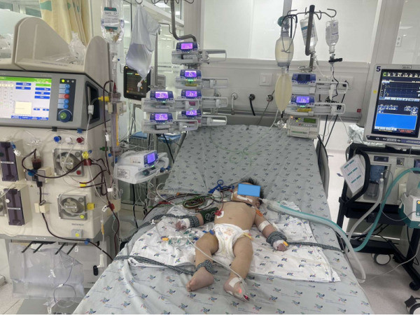 TP. HCM nhiều trường hợp trẻ bệnh tay chân miệng nặng được cứu sống