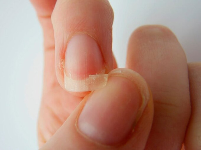 Những dấu hiệu đặc trưng cảnh báo cơ thể thiếu kẽm