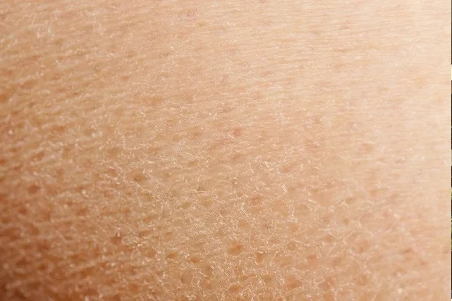9 nguyên nhân chính và cách khắc phục tình trạng da bong tróc