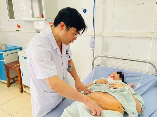 Hà Tĩnh thực hiện thành công ca mổ lấy thai cùng lúc phẫu thuật u xơ tử cung có kích thước rất lớn cho 1 sản phụ