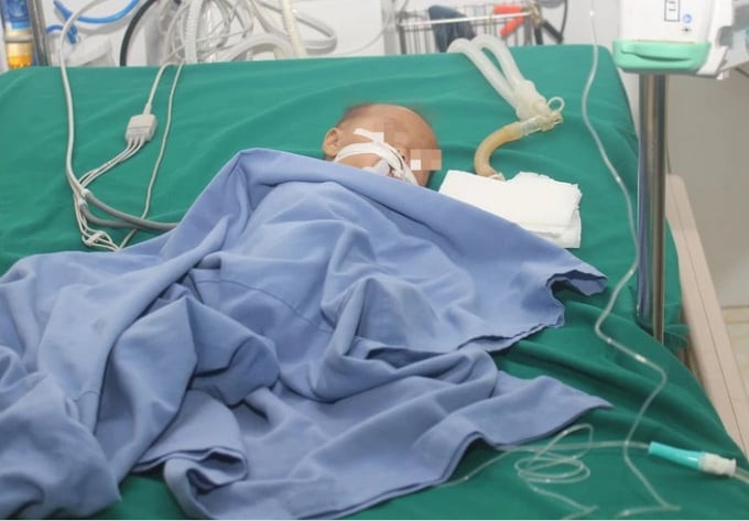 Bệnh viện đa khoa tỉnh Điện Biên điều trị cho bệnh nhi 4 tháng tuổi bị suy hô hấp, viêm phổi sặc, đuối nước