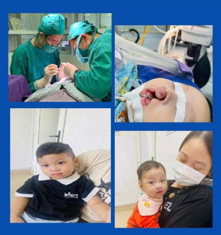 Quảng Ninh: Bé trai được phẫu thuật tạo hình môi từ 3 tháng tuổi, giờ đã trở lại bình thường như bao trẻ khác