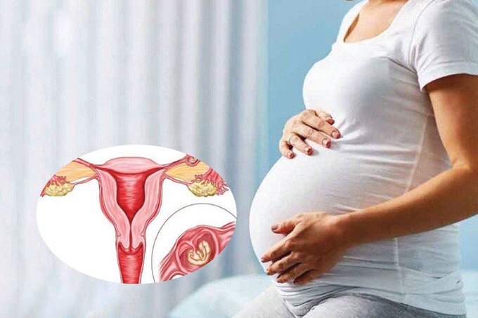 Quảng Ninh cấp cứu sản phụ trong tình trạng nguy kịch sốc mất máu do vỡ khối chửa ngoài tử cung