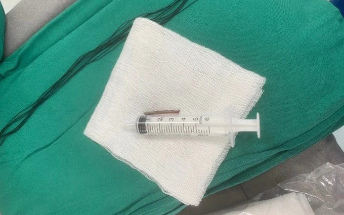 Hải Phòng phẫu thuật thành công trường hợp người bệnh bị tai nạn lao động hy hữu do súng bắn đinh