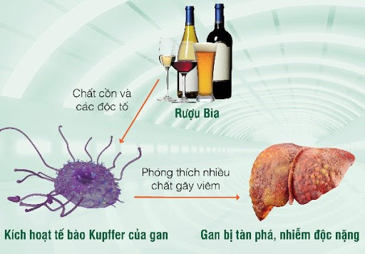 Quảng Ninh: Tỷ lệ bệnh nhân nhập viện do suy gan tăng