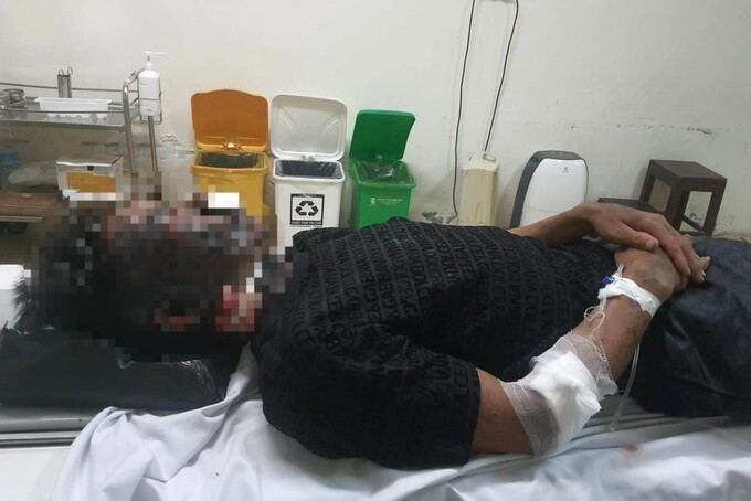 Ninh Bình: Hai người đàn ông bị sét đánh khi đi bắt cá ban đêm