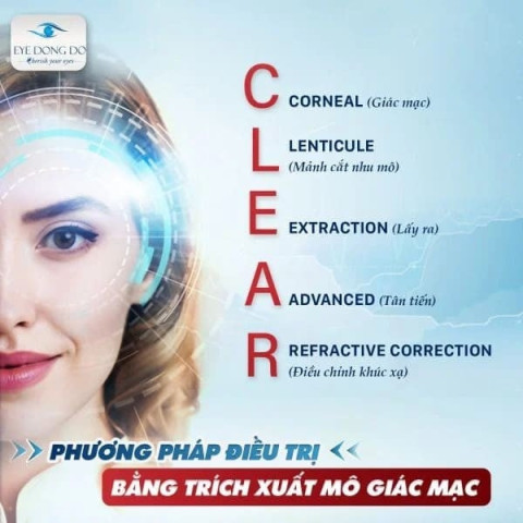 Phẫu thuật Clear - Công nghệ mổ cận thị tiên tiến nhất hiện nay