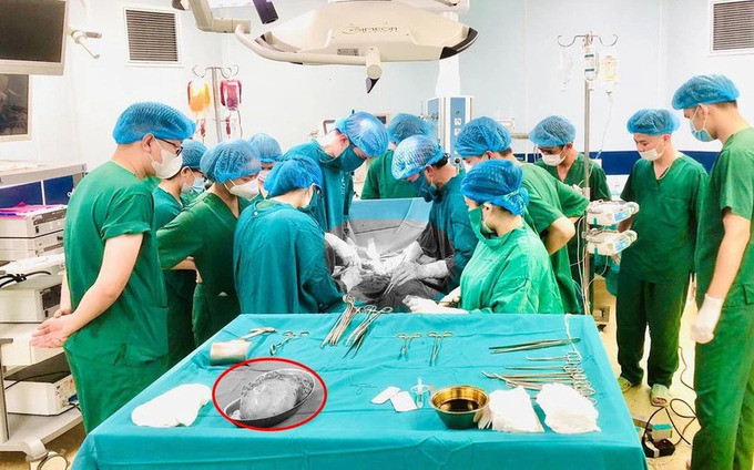 Bệnh viện Sản Nhi Phú Thọ phẫu thuật cứu sống 1 sản phụ 24 tuổi bị rau tiền đạo trung tâm, rau cài răng lược