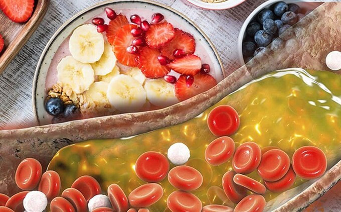 Cách kiểm soát cholesterol xấu trong cơ thể