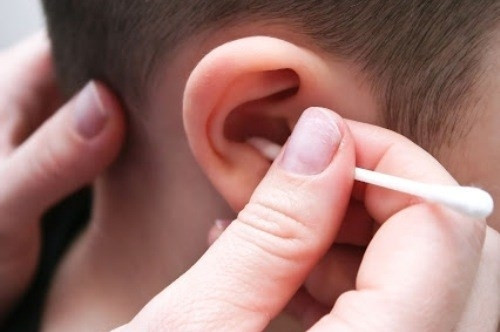 Bệnh viện Sản Nhi Nghệ An cấp cứu bé trai 5 tuổi bị thủng màng nhĩ do bất cẩn khi ngoáy tai