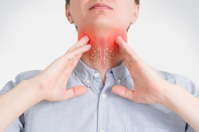 Bài thuốc hỗ trợ điều trị bệnh ung thư mũi họng