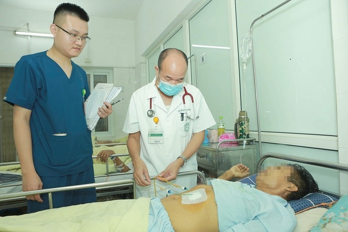 Hy hữu chuyện sán lá gan chui ra từ ống dẫn lưu đường mật của một nam bệnh nhân 57 tuổi ở Hoà Bình