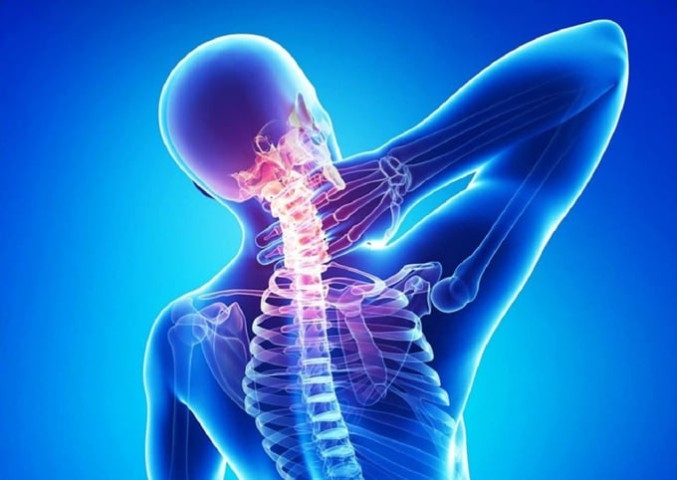 Vì sao người làm việc văn phòng dễ bị thoái hóa đốt sống cổ?