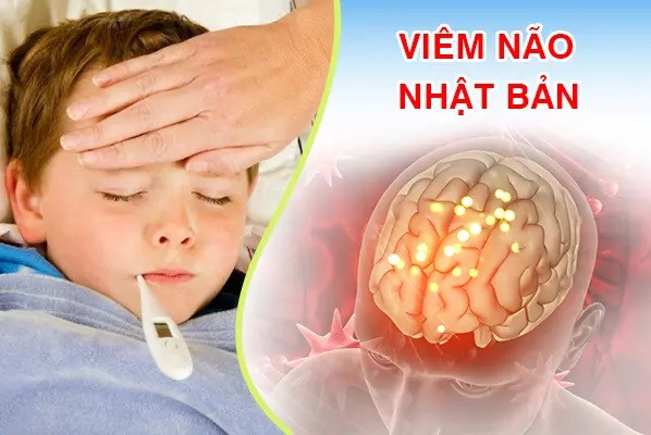 Phú Thọ: Bệnh viện Đa khoa Hùng Vương điều trị cho bé trai 7 tuổi bị viêm não Nhật Bản với di chứng nặng nề do đến viện muộn