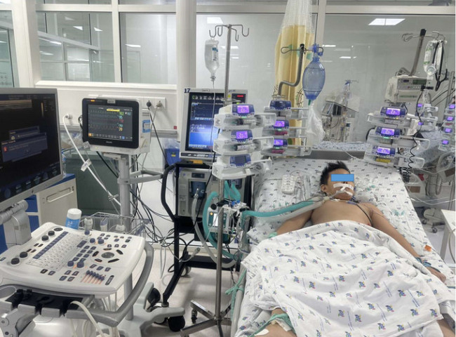 TPHCM: Bệnh viện Nhi Đồng Thành phố cứu sống bệnh nhi 9 tuổi bị viêm cơ tim, sốc tim, rối loạn nhịp tim nặng