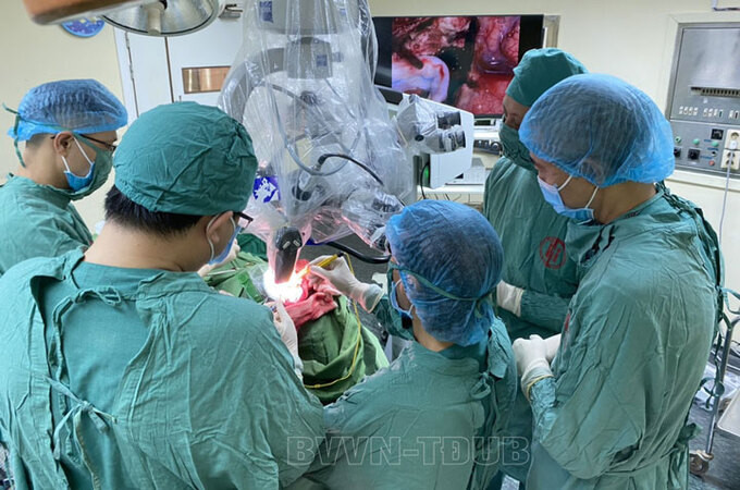 Bệnh viện Việt Nam – Thụy Điển Uông Bí phối hợp Bệnh viện Hữu nghị Việt - Đức cắt u màng não bằng kính hiển vi phẫu thuật