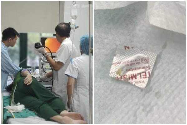 Hà Nội: Bệnh viện Hữu Nghị phẫu thuật gắp thành công một dị vật là 1 viên thuốc cả vỏ sắc nhọn ra khỏi thực quản của bệnh nhân