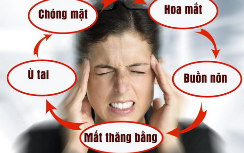 Y học cổ truyền điều trị rối loạn tiền đình nên hay không?