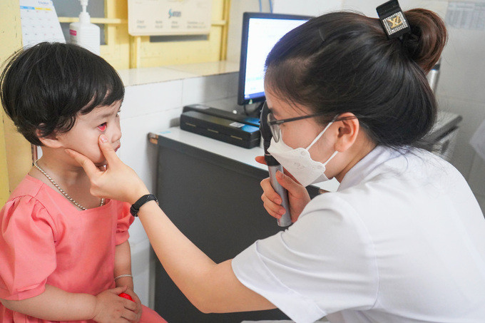 Bệnh viện Sản Nhi Nghệ An tiếp nhận từ 20 - 30 trẻ mắc bệnh đau mắt đỏ đến khám và điều trị mỗi ngày