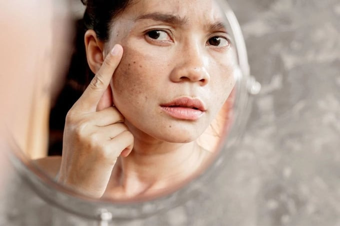 Da lão hóa cần lưu ý gì khi chăm sóc?