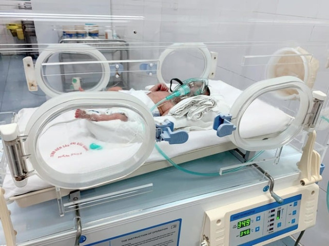 Bệnh viện Sản Nhi Bắc Giang nuôi dưỡng thành công bé trai chào đời ở tuần 25 thai kỳ nặng 600 gram
