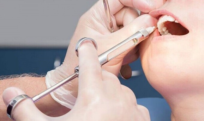 Quảng Ninh: Bệnh viện Đa khoa Khu vực Cẩm Phả cấp cứu bệnh nhân bị ngộ độc thuốc tê toàn thân khi đi chữa răng