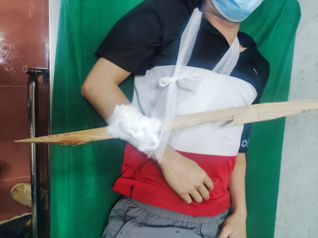 Hà Nội: Bệnh viện Đa khoa huyện Thạch Thất tiếp nhận rất nhiều bệnh nhân bị chấn thương do tai nạn lao động