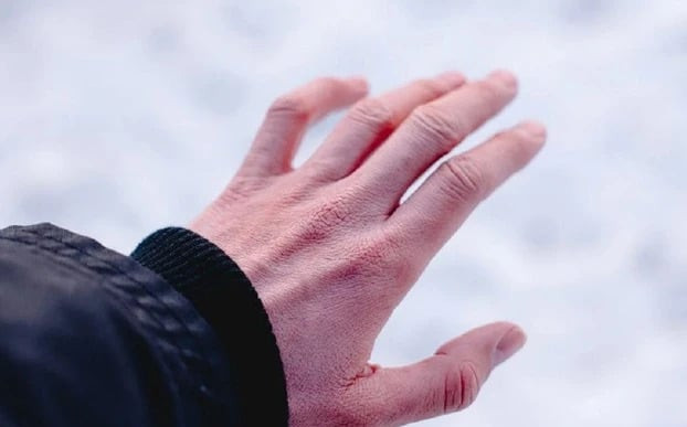 Vì sao một người chịu lạnh rất kém?