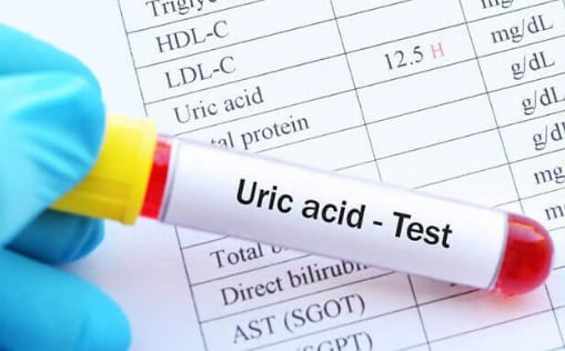 Mối liên quan giữa axit uric cao với gan và thận