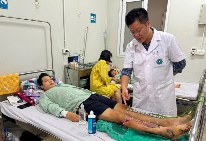 Hà Nội: Cấp cứu nam thanh niên bị gãy 1/3 trên 2 xương cẳng chân phải và tổn thương nghiêm trọng mạch máu