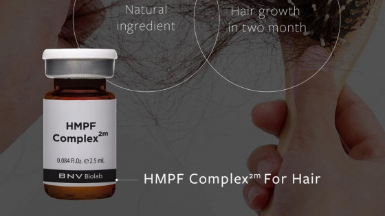 Nguyên nhân gây bệnh hói đầu – Tiết lộ bí quyết của chuyên gia