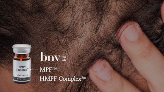 HMPF Complex 2m giải pháp phục hồi nang tóc độc quyền từ USA