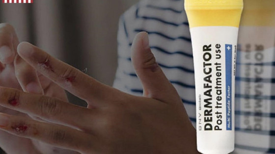 Dermafactor hiệu quả sử dụng cho mọi lứa tuổi
