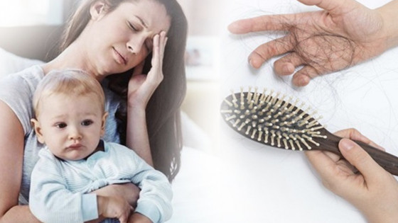 Hiệu quả điều trị rụng tóc sau sinh