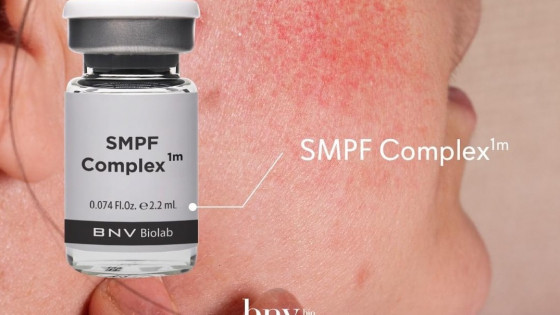 SMPF Complex 1M – Giải pháp toàn diện cho tất cả vấn đề trên da