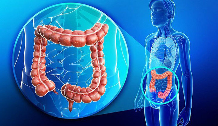 Quảng Ninh: Phẫu thuật thành công và điều trị ung thư đại tràng sigma biến chứng bán tắc ruột cho 1 bệnh nhân 76 tuổi