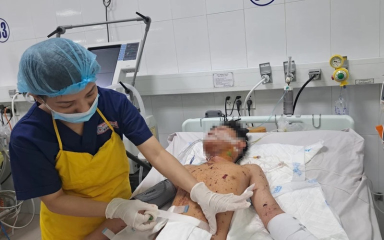 Đà Nẵng: Điều trị cho 1 trường hợp đa chấn thương nặng do chơi pháo phát nổ