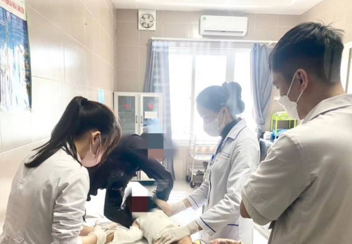Lạng Sơn liên tiếp điều trị 2 trường hợp trẻ nhỏ bị bỏng trong sinh hoạt tại nhà do sự bất cẩn của người lớn