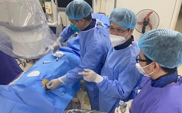 Lần đầu tiên các y bác sĩ thực hiện thành công nội soi lấy tổ chức tụy hoại tử qua da