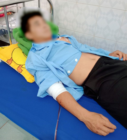 Đắk Lắk cứu chữa kịp thời cho một bệnh nhân bị chó nuôi cắn