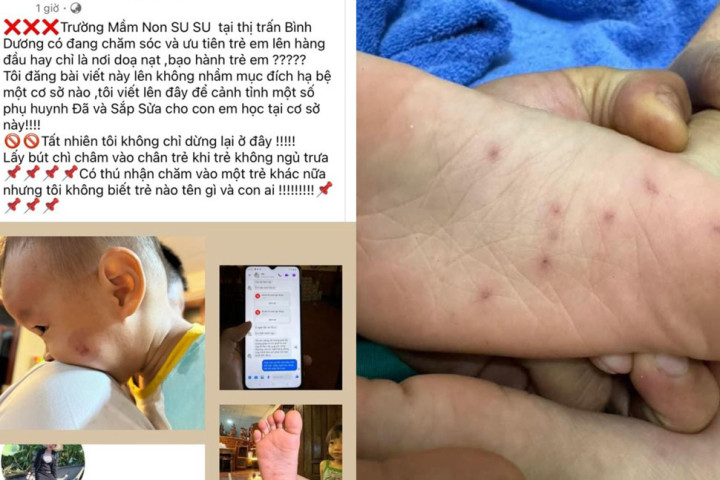 Bình Định: Công an vào cuộc làm rõ thông tin 2 bé học mầm non bị cô giáo bạo hành