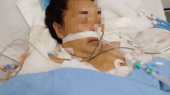 Thanh Hóa: Nữ bệnh nhân nguy kịch sau khi mổ ruột thừa tại Bệnh viện Đa khoa huyện Như Thanh đã tử vong