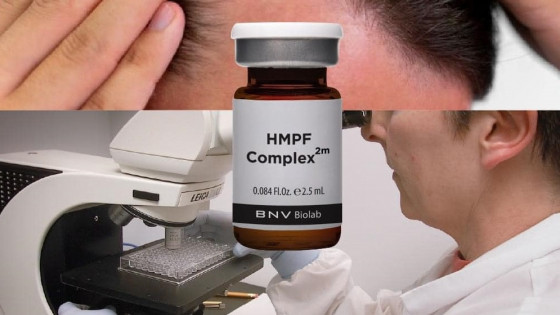 Lợi ích dài hạn của việc sử dụng HMPF Complex 2m cho tóc