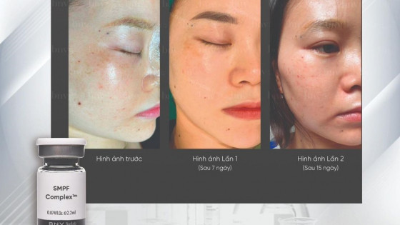 Công nghệ hiện đại MPF™ và ứng dụng trong lĩnh vực y học: Nâng cao sức khỏe tế bào