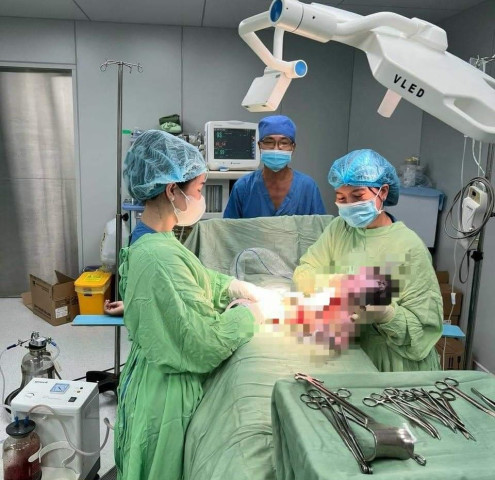 Bình Dương: Mổ cấp cứu giúp người phụ nữ sinh 3 con thành công