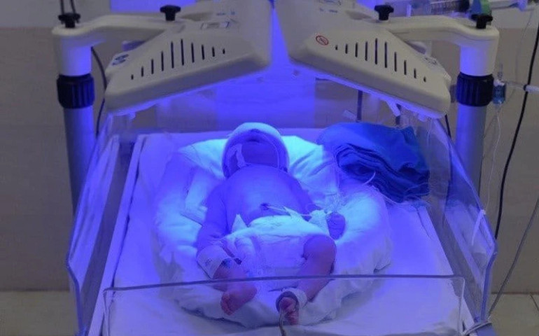 Hải Phòng: Trẻ sơ sinh bị vàng da tăng Bilirubin do bất đồng nhóm máu với mẹ