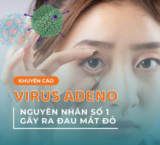 Virus Adeno: Nguyên nhân số 1 gây ra dịch đau mắt đỏ trong giai đoạn cuối mùa xuân