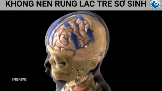 Chuyên gia khuyến cáo: Không nên rung lắc trẻ sơ sinh