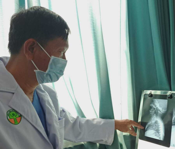 TP. Hồ Chí Minh: Lấy dị vật là chiếc kim tây 3 cm trong thực quản của bé trai 10 tháng tuổi